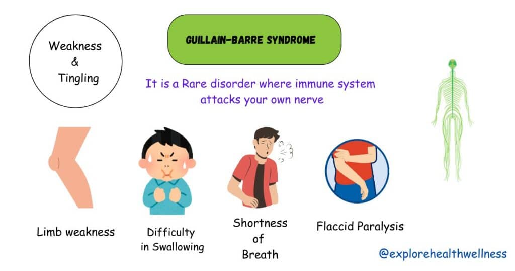 Guillain-Barré syndrome symptoms