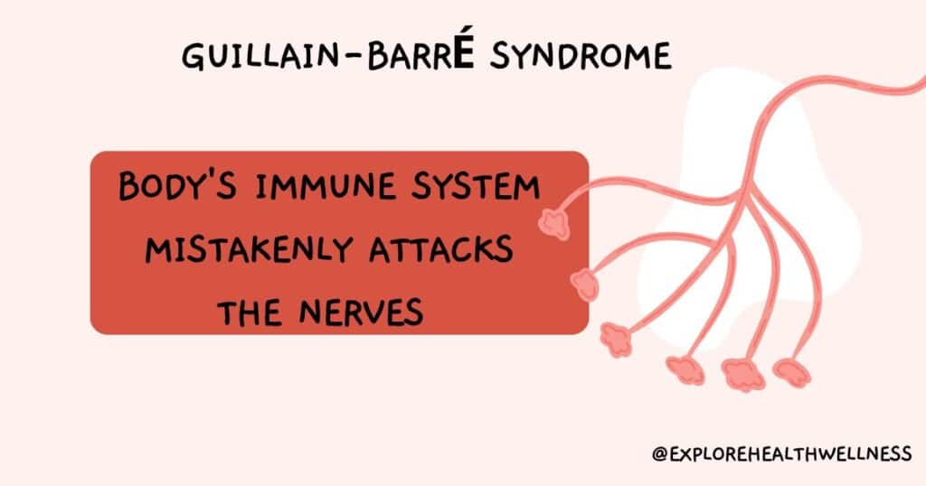 Guillain-Barré syndrome -Symptoms and Treatment 